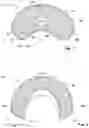 Fig. 02 - Individually Adaptable Dental Impression Tray for Dental Fine Impression