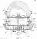 Fig. 05 - Non-Surgical Anti-Aging Denture Facelift System