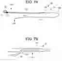 Fig. 07 - Flexible implant with adjustable coils