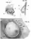 Fig. 03 - Soft tissue repair grafts and processes for preparing and using same