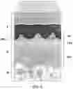 Fig. 04 - Soft tissue repair grafts and processes for preparing and using same