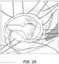 Fig. 03 - VALVED STENT FOR ORTHOTOPIC REPLACEMENT OF DYSFUNCTIONAL CARDIAC VALVE AND DELIVERY SYSTEM
