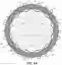 Fig. 11 - VALVED STENT FOR ORTHOTOPIC REPLACEMENT OF DYSFUNCTIONAL CARDIAC VALVE AND DELIVERY SYSTEM