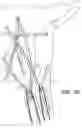 Fig. 14 - VALVED STENT FOR ORTHOTOPIC REPLACEMENT OF DYSFUNCTIONAL CARDIAC VALVE AND DELIVERY SYSTEM