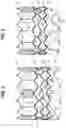 Fig. 03 - Prosthetic heart valve having leaflet inflow below frame