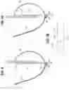 Fig. 04 - Prosthetic heart valve having leaflet inflow below frame