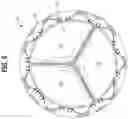 Fig. 05 - Prosthetic heart valve having leaflet inflow below frame