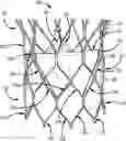 Fig. 01 - Leaflet suturing to commissure points for prosthetic heart valve
