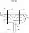 Fig. 11 - Leaflet suturing to commissure points for prosthetic heart valve