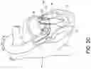 Fig. 05 - Transcatheter atrio-ventricular valve prosthesis