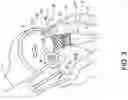 Fig. 08 - Transcatheter atrio-ventricular valve prosthesis