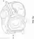 Fig. 26 - Transcatheter atrio-ventricular valve prosthesis