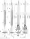 Fig. 05 - DEVICES AND METHODS FOR TRANSCATHETER RETRIEVAL OF MECHANICAL HEART VALVE LEAFLETS