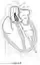 Fig. 09 - DEVICES AND METHODS FOR TRANSCATHETER RETRIEVAL OF MECHANICAL HEART VALVE LEAFLETS
