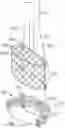 Fig. 01 - System for mitral valve repair and replacement