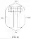 Fig. 07 - System for mitral valve repair and replacement
