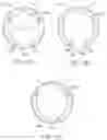 Fig. 10 - System for mitral valve repair and replacement