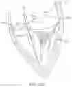 Fig. 19 - System for mitral valve repair and replacement