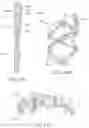 Fig. 21 - System for mitral valve repair and replacement