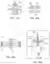 Fig. 30 - System for mitral valve repair and replacement