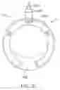 Fig. 31 - System for mitral valve repair and replacement