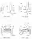 Fig. 37 - System for mitral valve repair and replacement