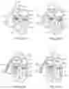 Fig. 42 - System for mitral valve repair and replacement