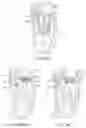 Fig. 47 - System for mitral valve repair and replacement