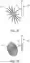 Fig. 11 - System for treating hypertrophic cardiomyopathy and left ventricular outflow tract obstruction