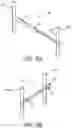 Fig. 12 - System for treating hypertrophic cardiomyopathy and left ventricular outflow tract obstruction