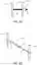 Fig. 13 - System for treating hypertrophic cardiomyopathy and left ventricular outflow tract obstruction