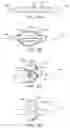 Fig. 07 - Steerable lesion excluding heart implants for congestive heart failure