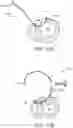 Fig. 11 - Steerable lesion excluding heart implants for congestive heart failure