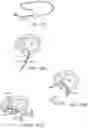 Fig. 12 - Steerable lesion excluding heart implants for congestive heart failure