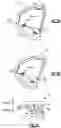 Fig. 04 - Components for artificial joints