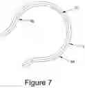 Fig. 06 - Hip interpositional spacer