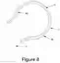 Fig. 07 - Hip interpositional spacer