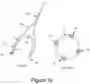 Fig. 09 - Hip interpositional spacer