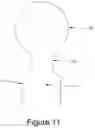 Fig. 10 - Hip interpositional spacer