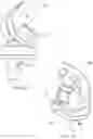 Fig. 17 - ANATOMICAL MOTION HINGED PROSTHESIS