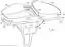 Fig. 01 - Anterior locking clip