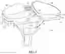Fig. 05 - Anterior locking clip