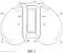 Fig. 06 - Anterior locking clip
