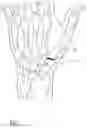 Fig. 02 - Interposition implants for the hand