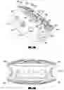 Fig. 03 - Dynamic intervertebral spacer implant