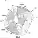 Fig. 02 - Dynamic intervertebral spacer implant