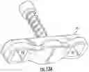 Fig. 17 - Expandable and adjustable lordosis interbody fusion system