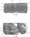Fig. 28 - Expandable and adjustable lordosis interbody fusion system