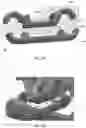 Fig. 30 - Expandable and adjustable lordosis interbody fusion system