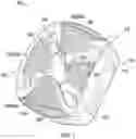 Fig. 02 - Dynamic intervertebral spacer implant